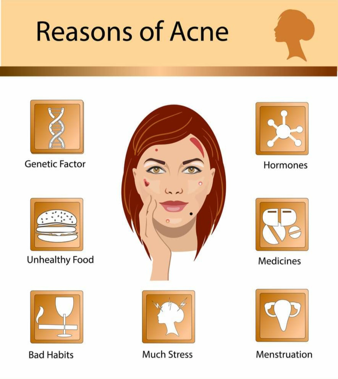 Acne Behandelingen